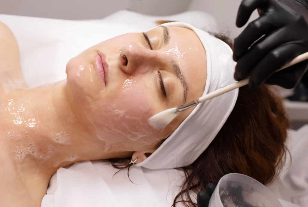Glycolic Peels in Altamonte Springs, FL
