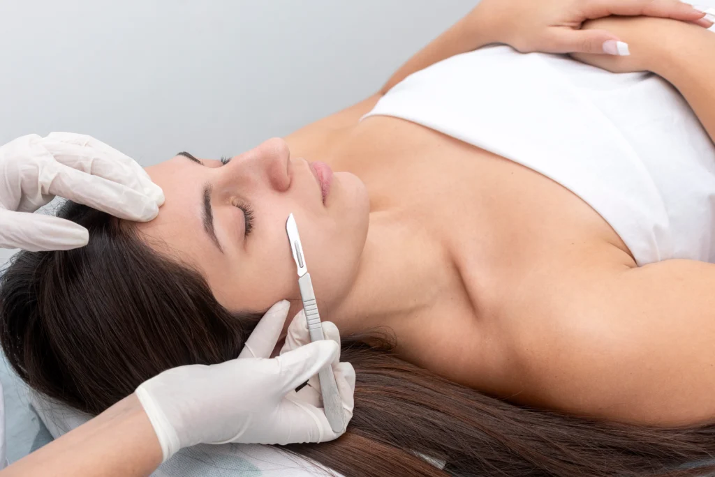 dermaplaning-altamonte-springs-fl