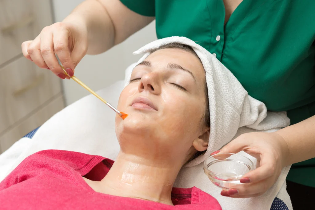 tca-peels-in-altamonte-springs-fl